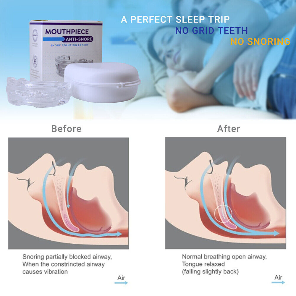 Anti snoring mouthguard