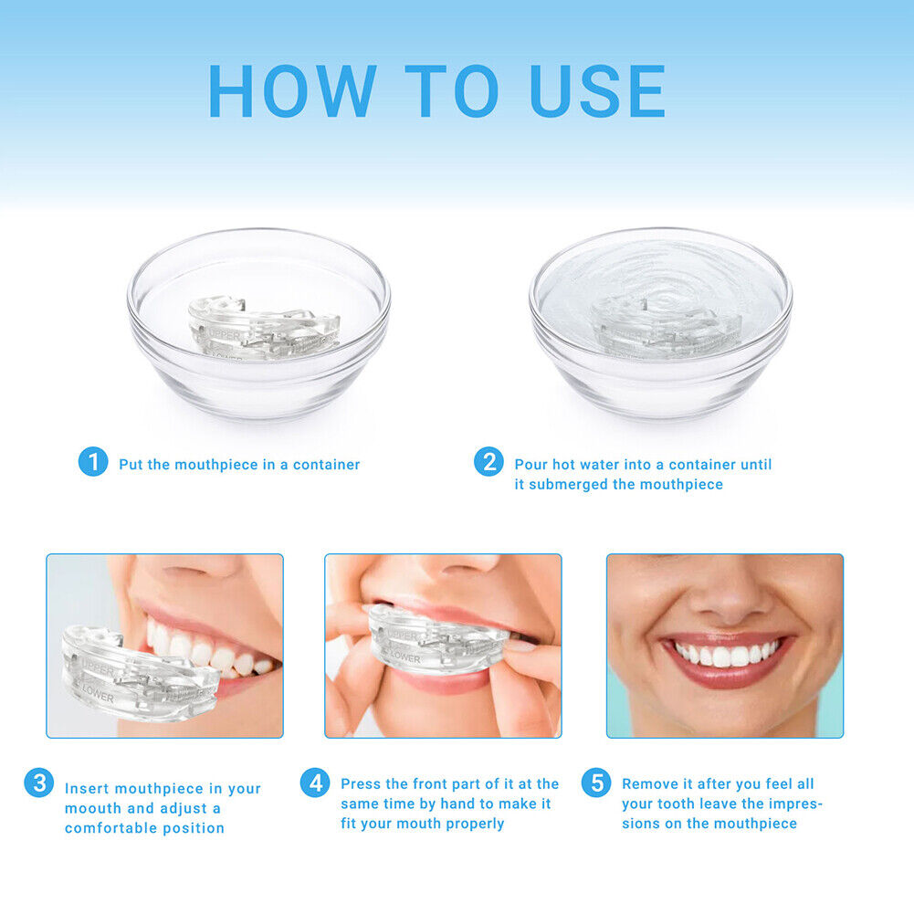 Anti snoring mouthguard